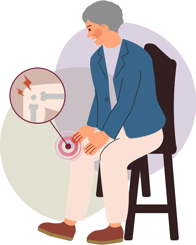 Arthritis Treatments